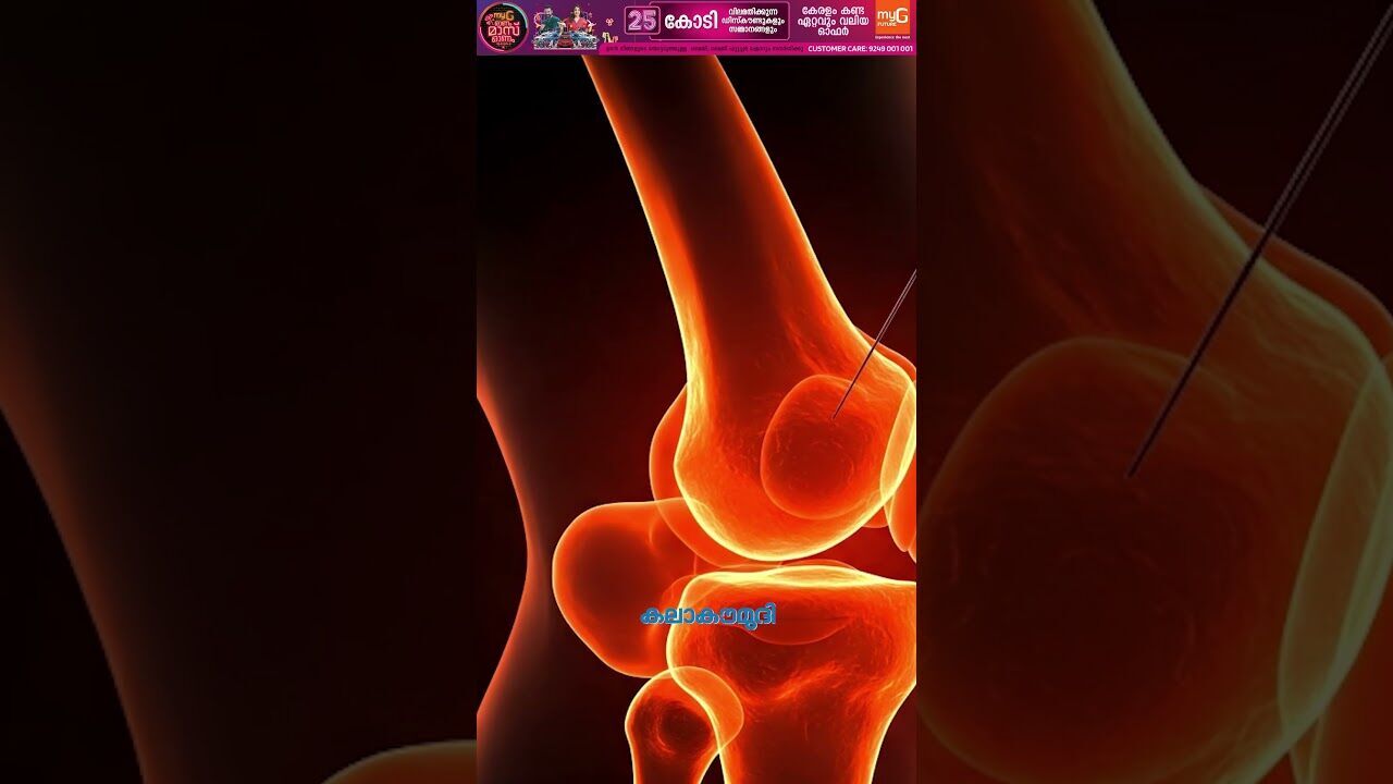 എല്ലൊടിഞ്ഞോ? മൂന്നു മിനിട്ടു മതി പശ വച്ച് ഒട്ടിച്ചുചേര്‍ക്കാം! | Health News | Kalakaumudi Online